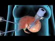 Видео обзор на Поддержка печени, Organic Liver & Gallbladder, 90 г