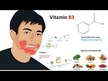 Видео обзор на Ниацинамид, Niacinamide B-3 Timed Release 1500 mg, 100 таблеток