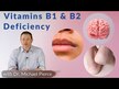 Відео огляд на Vitamin B-2 100 mg, Вітамін В2 Рибофлавін 100 мг, 100 таблеток