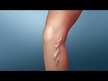 Видео обзор на Future Biotics, Поддержка вен ног, VeinFactors, 180 капсул