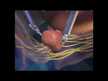 Видео обзор на Здоровье простаты, Prostate Health, 60 капсул